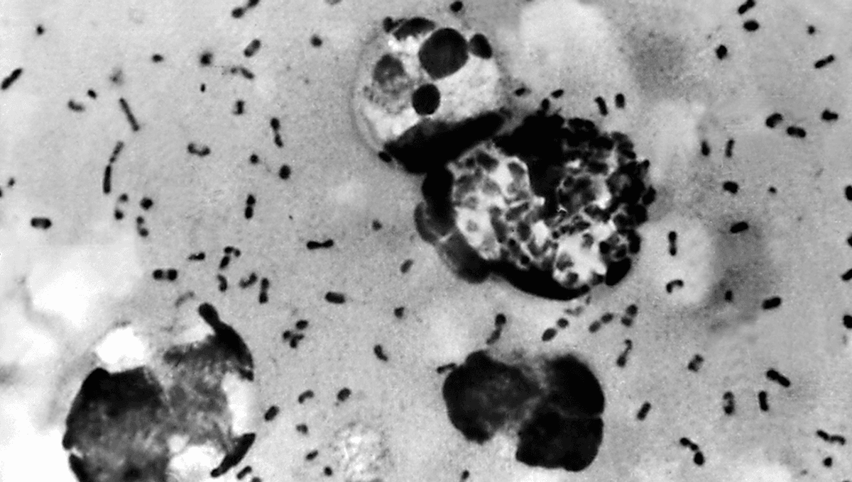 DNA em vala comum confirma Yersinia pestis na Peste de Justiniano - Imagem do artigo