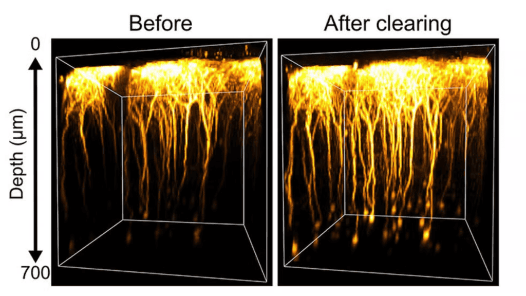 remansonoticias 1774355413